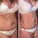 temoignage-laetitia-2-noemie-nutrition-min